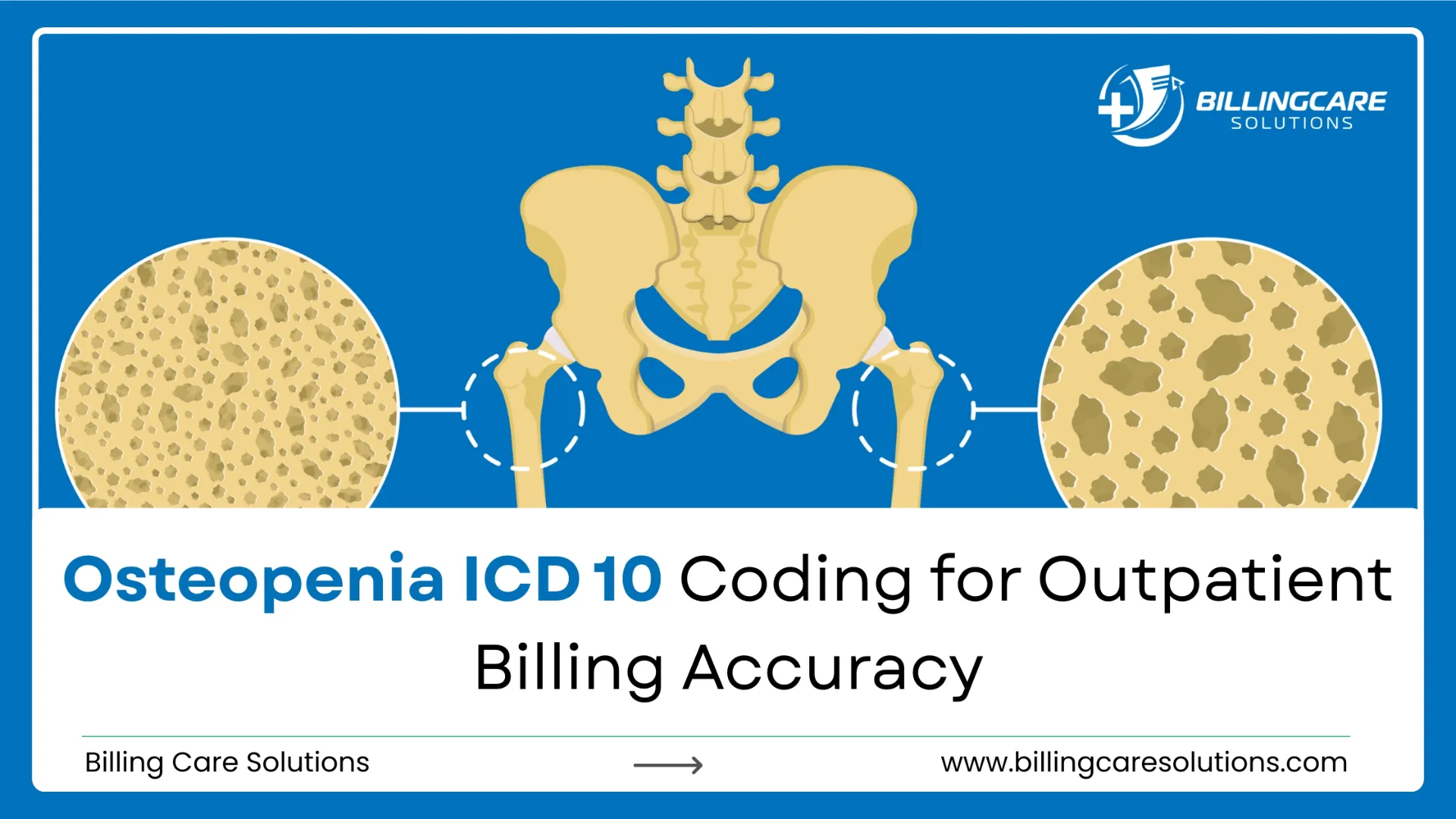 Osteopenia ICD 10 | Billing Care Solutions
